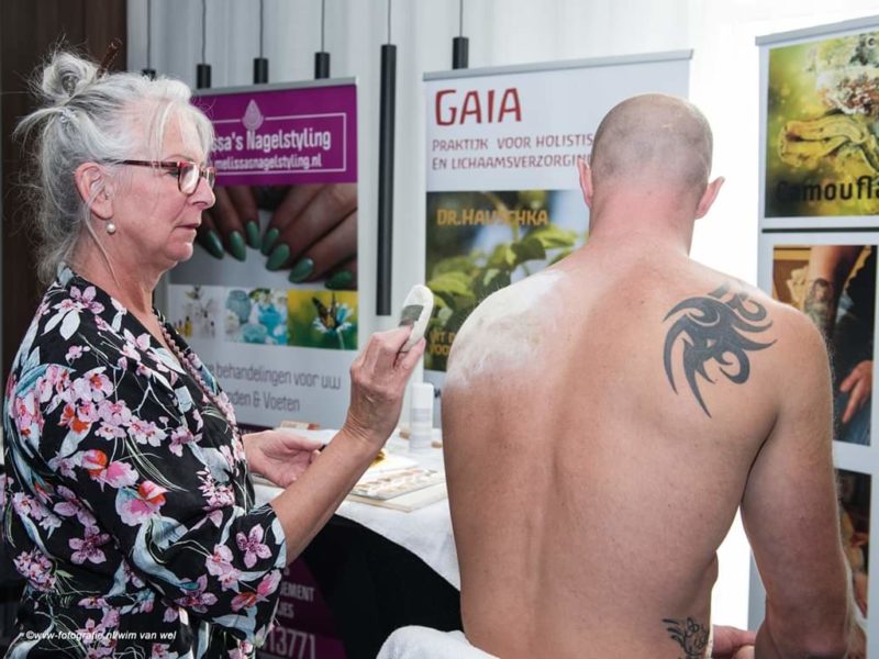 Ik ga trouwen en wil geen tattoo op de foto! Ik ga trouwen en wil geen tattoo op de foto!